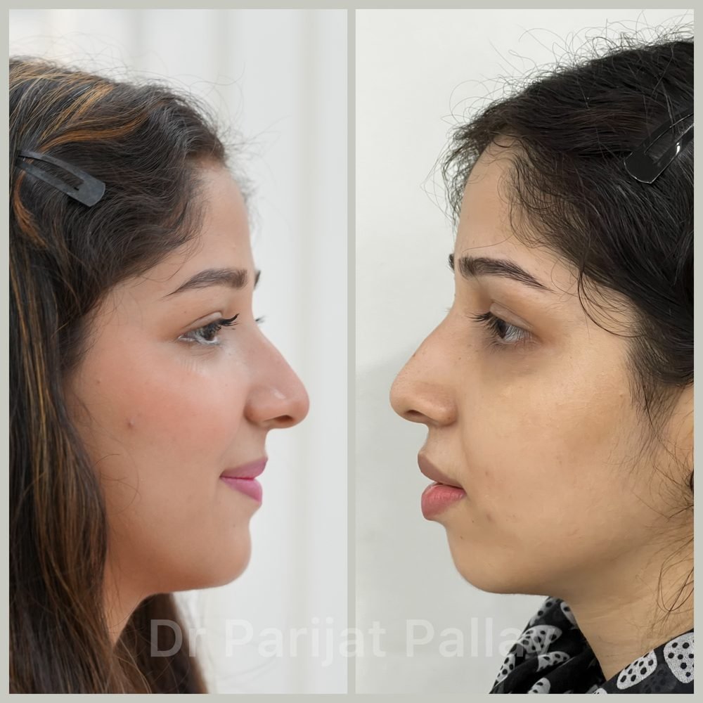 Balaji Dental patient की treatment से पहले और बाद की smile